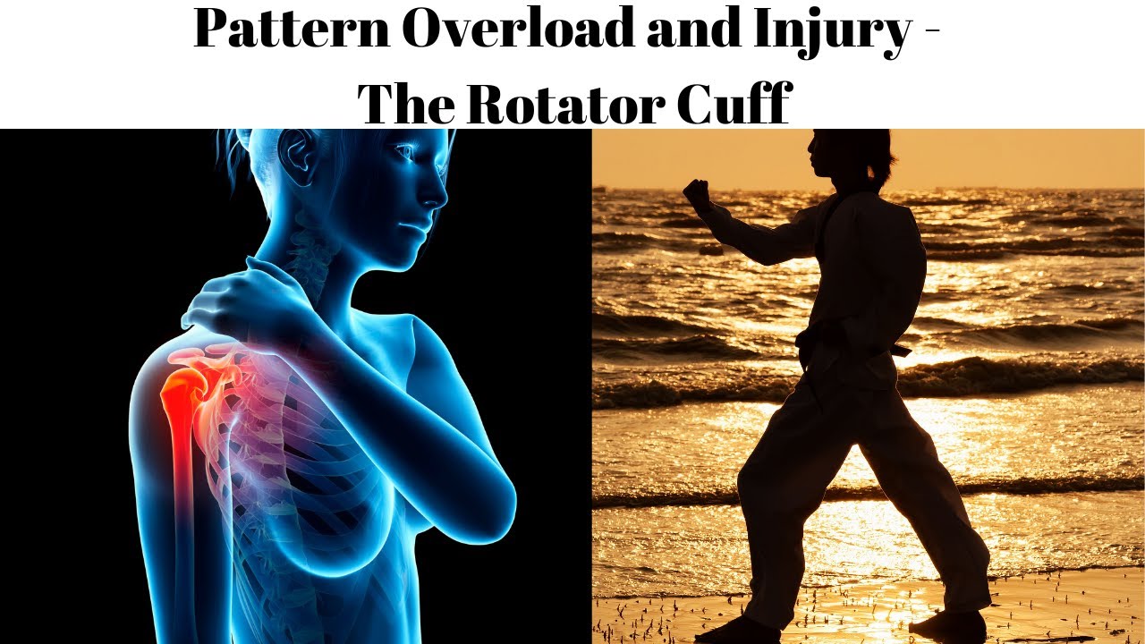 Pattern Overload: Injury Prevention for Shoulder and Rotator Cuff