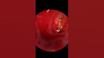 Strawberry under a microscope #shorts