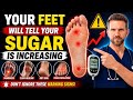 🦶⚠️ Doctors Warn: 9 Warning Signs in Your Feet That Could Mean Diabetes (Don’t Ignore!)|Dr Richard