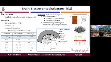 VSIP 2022 China: Invited Speech- Dr. Kafiul- "Recent Trends in Artifact Detection and Removal".