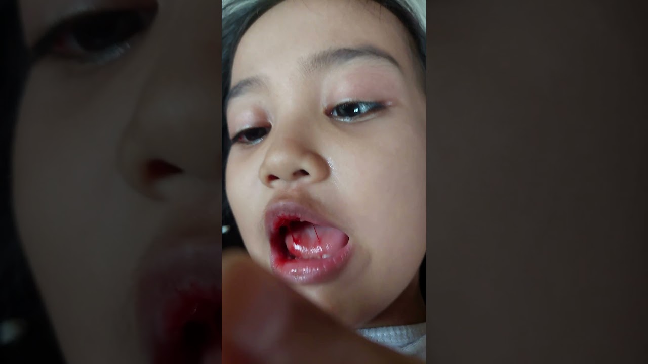 Drama Cabut gigi ga sakit #jayantinavfamily #lucu #shorts