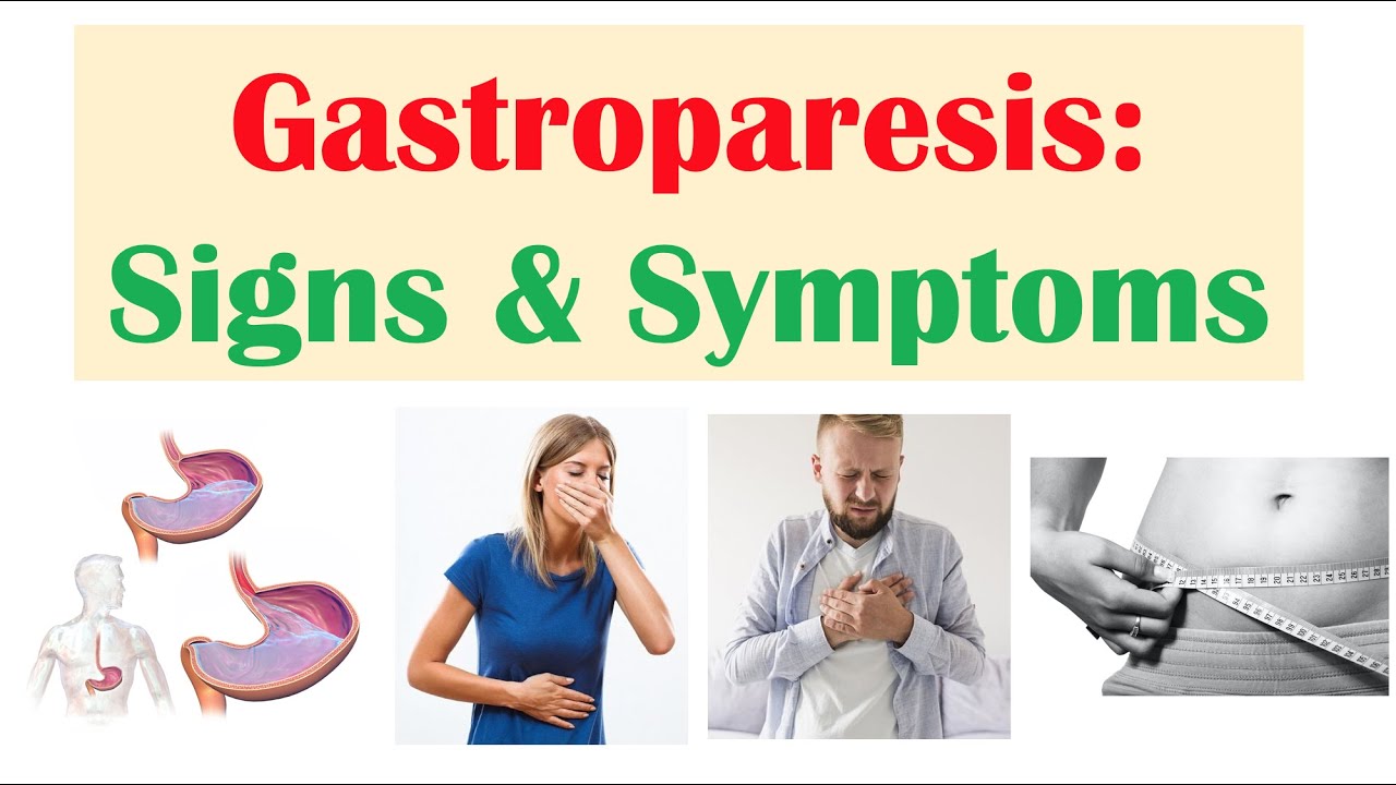 Diabéteszes gastroparesis elleni orrspray