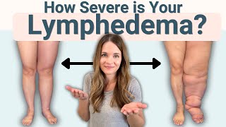 The Stages of Lymphedema - How Severe is Your Swelling?
