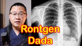 Rontgen Dada. Foto Dada. Yuk BELAJAR bersama.