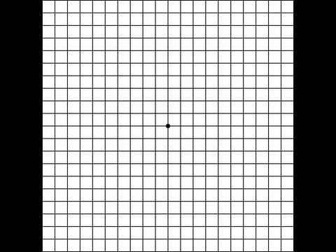 Macular Degeneration Vision Test Using Amsler Grid You Macular Degeneration Vision Test Using Amsler Grid