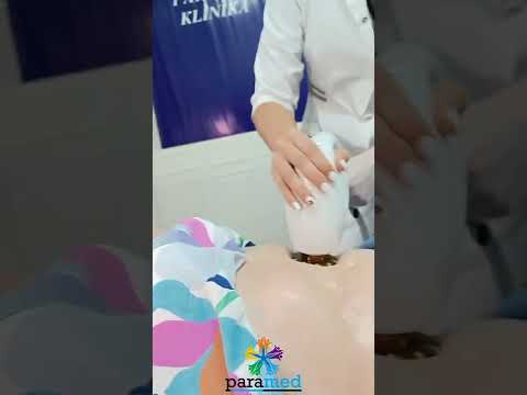 Accent Prime ilə bədən şəkilləndirmə