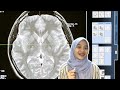 Macam Mana Nak Unlock Subconscious Mind?