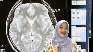 Macam Mana Nak Unlock Subconscious Mind?