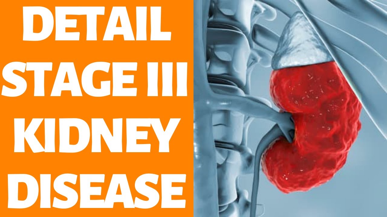 Detail Stage 3 Kidney Disease - Treatment For Kidney Disease At Home