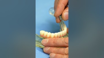 Biominiatures Implants, Minimally Invasive Implant Dentistry