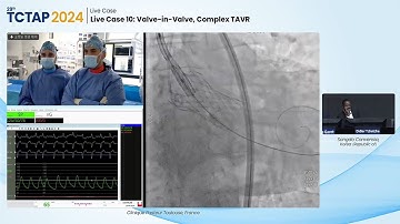 [TCTAP 2024] Live Case 10: Valve-in-Valve, Complex TAVR