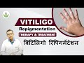 Vitiligo repigmentation   therapy  treatment  care well medical centre