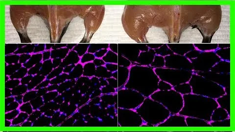 Crispr breakthrough may enable treatment for genetic diseases