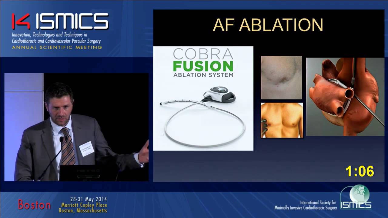 Successful Endoscopic Surgical Ablation in Persistent Atrial