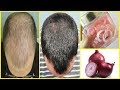 20 दिनों में प्याज के रस से बालों को Regrowth करे | Onion Juice For Hair Loss And Hair Regrowth