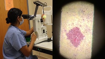 Principles of Laser Surgery on Model Eye: LPI and SLT