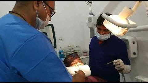 Bio - care basal implant placement