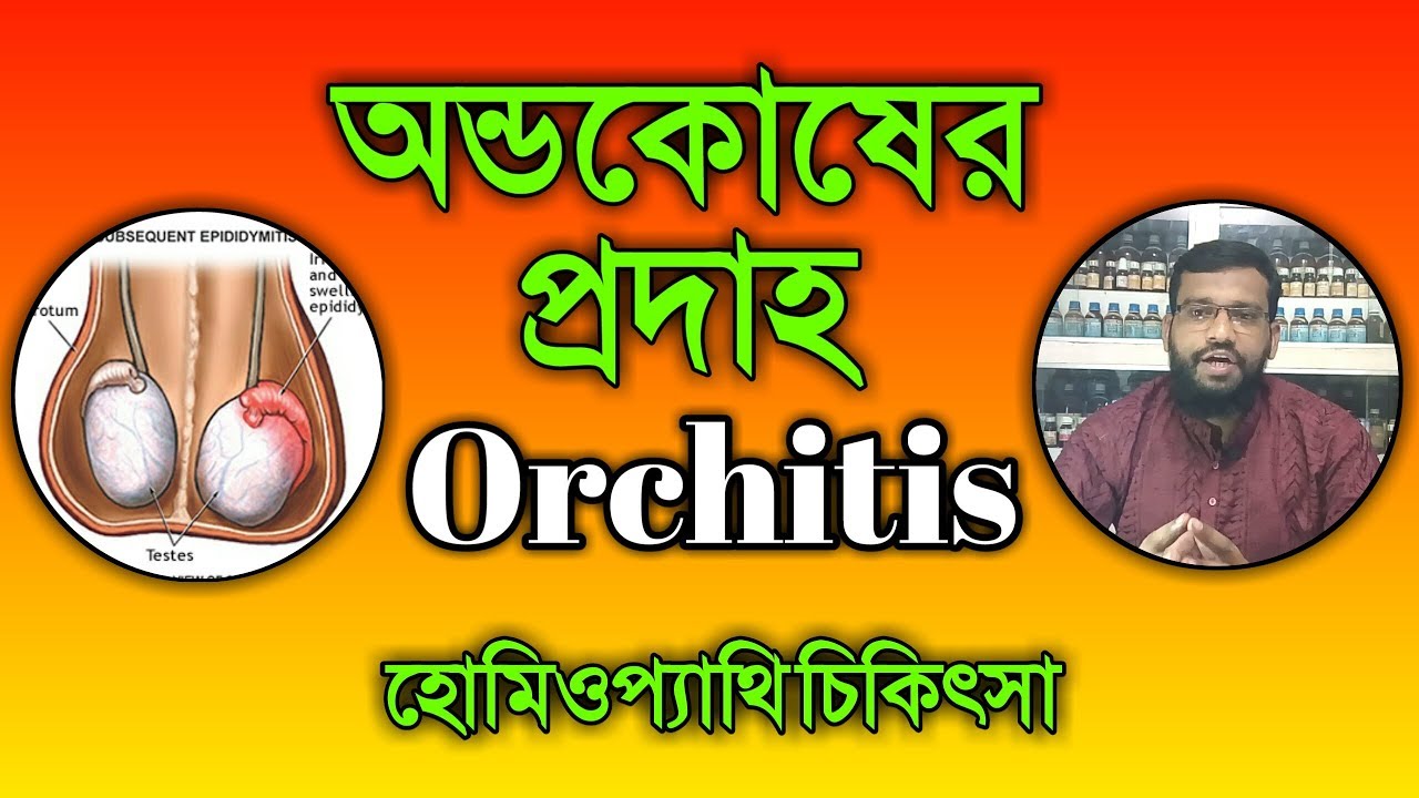 অন্ডকোষের প্রদাহ ব্যাথা অরকাইটিস রোগের হোমিওপ্যাথি চিকিৎসা | orchitis homeopathy treatment in bangla