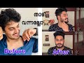 രണ്ടാഴ്ച കൊണ്ട് താടി വന്നു|Tips| beard oil | ഇത് തേച്ചു നോക്ക് താടി കട്ടിക്ക് വന്നു തുടങ്ങും