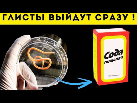 ГЛИСТЫ ПУЛЕЙ ВЫЛЕТЯТ ЗА НОЧЬ! НАРОДНОЕ СРЕДСТВО ЗА КОПЕЙКИ! ЭТИ 5 ПРОДУКТОВ ИЗГОНЯТ....