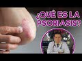 Que es la Psoriasis? (Dr Javier E Moreno)