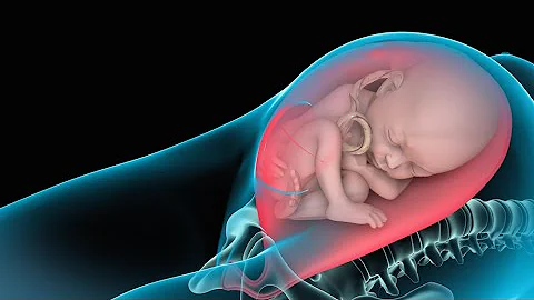 ¿Qué le ocurre al cuello del útero cuando le practican una cesárea?