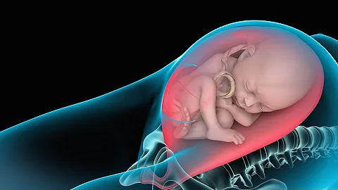 ¿Qué le ocurre al útero después de una cesárea?
