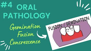 Gemination|Fusion|Concrescence