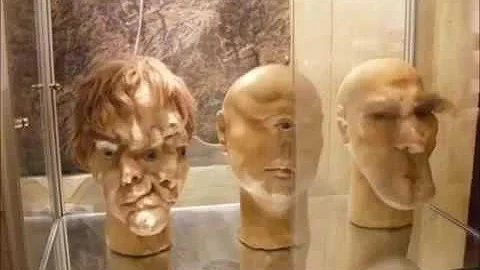 تحميل 閲覧注意 恐怖の難病 奇形人間 奇形児画像 ココロ刺激 تحميل 閲覧注意 恐怖の難病 奇形人間 奇形児画像 ココロ刺激