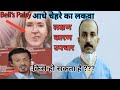 #dental #Bells_palsy आधे चेहरे का लकवा | कारण, लक्षण, उपचार | घरेलू उपाय