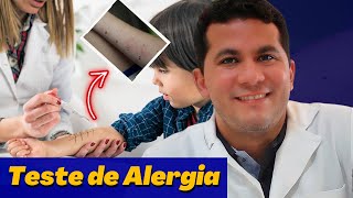 TESTE DE ALERGIA NO BRAÇO │ PRICK TESTE  │ MEU EXAME