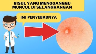 Penyebab Bisul Muncul di Selangkangan dan Cara Mengatasinya