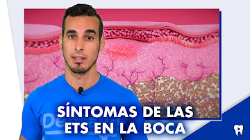 ¿Qué ETS te produce síntomas parecidos a los de la gripe?