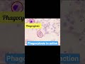 Phagocytosis in action–the immune army at work🦠🔬 #PathoScopelab #Immunity #malaria#microscopy#shorts