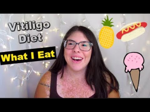 Video: Vitiligo Voorkomen Met Uw Dieet En Huismiddeltjes