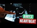 Hearing Baby&#39;s HEARTBEAT! ❤️