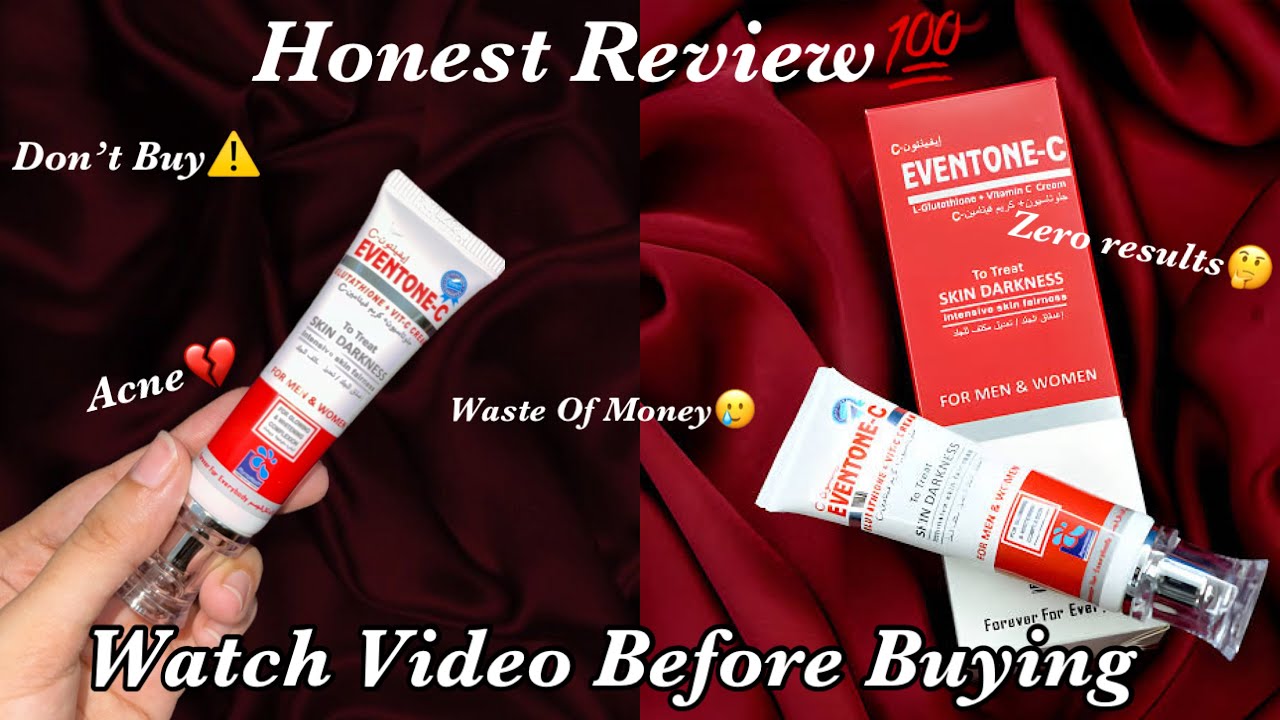 Purpose Of Eventone C Cream
