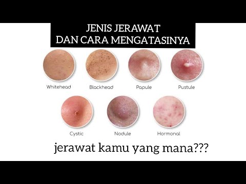 JENIS JERAWAT DAN CARA MENGATASINYA