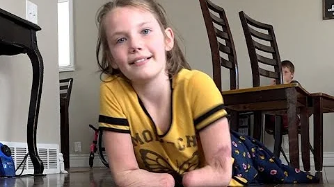 She lost her limbs but never lost hope. How Rosali...