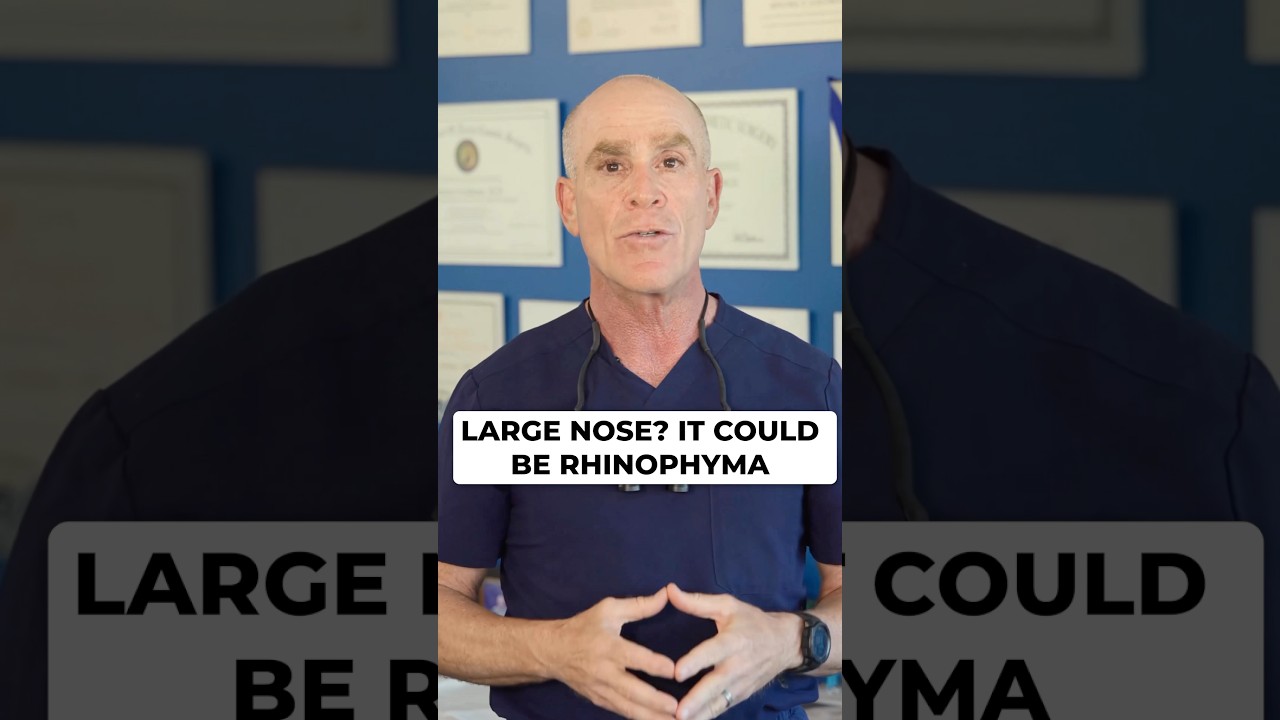 Banner for Rhinophyma: How We Sculpt & Reduce Enlarged Noses