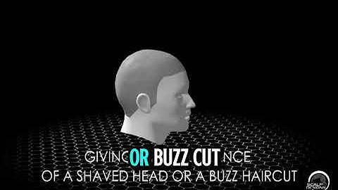 Scalp Micropigmentation Boston | The Most Realistic Hairline Restoration in MA