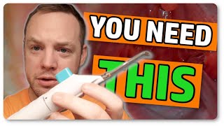 Top 2 Tonsil Stone Removal Tools  Better Than A Cotton Swab!