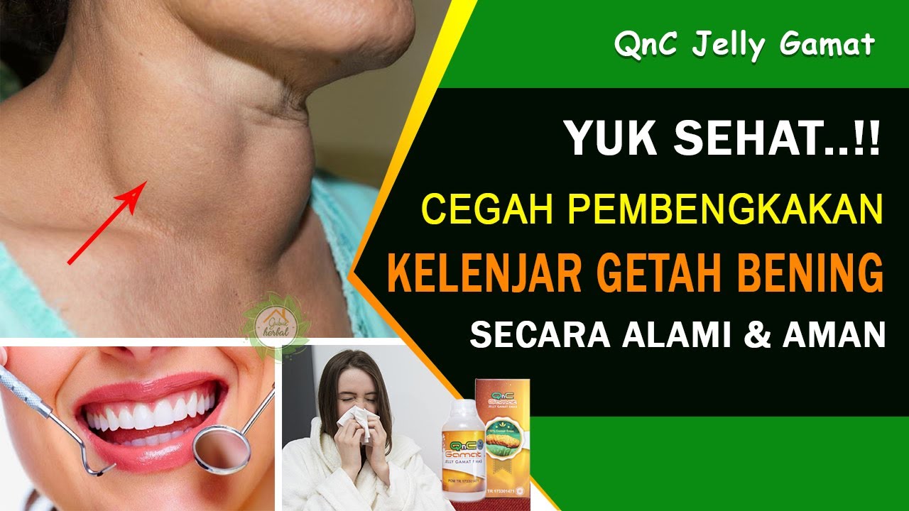 Cara Mancegah Pembengkakan Kelenjar Getah Bening - QnC Jelly Gamat
