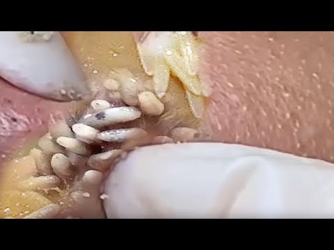 traitement-facial-incroyable-pour-des-soins-de-la-peau-éclatants-et-un-visage-de-beauté-#ep0012
