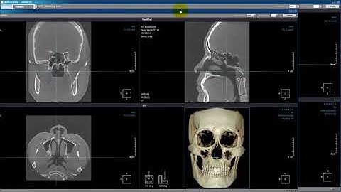 Xelis Dental General Case USB Publisher