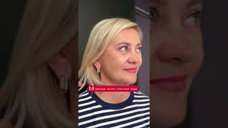 Минус 10 лет за одну операцию — лоб, веки, лицо и шея в одном фулл-фейсе #фейслифтинг