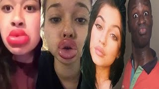 Kylie jenner lip challenge reaction ...