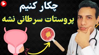 چکار کنیم مبتلا به بیماریهای پروستات نشیم؟ نکاتی که میتونه زندگیت رو نجات بده