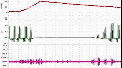Blood pressure recording using Power Lab© system (Registered™ of AD Instruments, Australia)