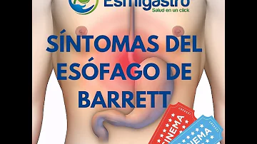 ¿Cuáles son los principales síntomas del esófago de Barrett?